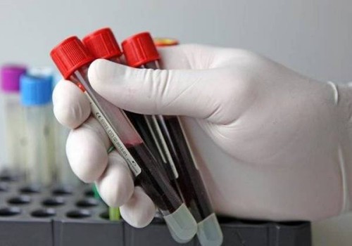 杭州供卵：在意大利私立医院做试管婴儿怎么样,试管婴儿在私立医院有保障吗